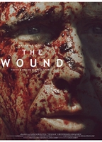 THE WOUND