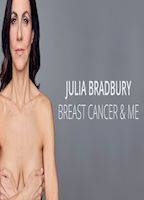 JULIA BRADBURY: BREAST CANCER AND ME