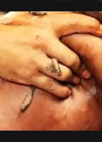 CEPHALIC CARNAGE: OHRWURM